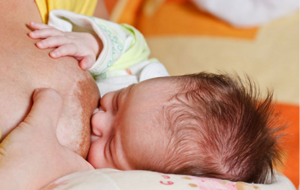 Kỹ thuật ép bầu vú ở vị trí ôm bóng (football hold) Dùng ngón cái đặt lên bầu vú và các ngón khác ở dưới bầu vú, nhẹ nhàng ép (nặn) về phía quầng thâm và núm vú khi bé bú. Nguồn ảnh: Breastfeeding Support 