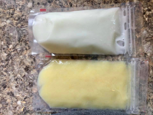 Bức ảnh chứng minh sự thần kỳ của sữa mẹ