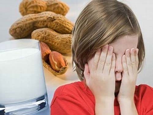 trẻ mản ngứa, kiêng ăn gì?