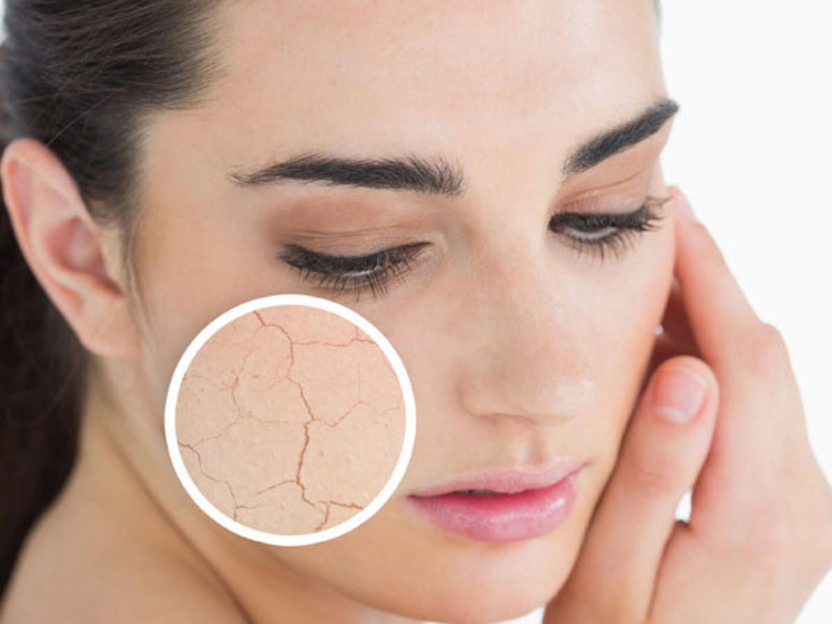 Bí quyết giúp chị em dưỡng ẩm cho da khỏi khô nẻ vào mùa đônag