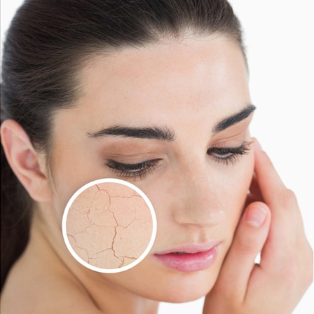 tăng cân, mãn kinh, béo phì, béo bụng tăng cân, mãn kinh, béo phì, béo bụng