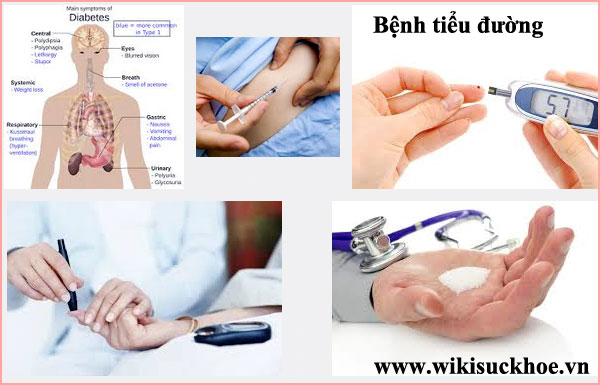 4 cách điều trị tiểu đường phổ biến nhất
